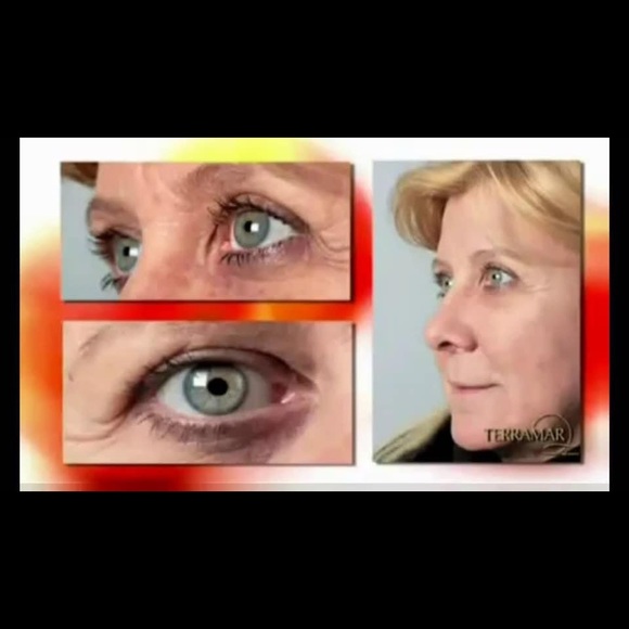 Cellular Strength System - Picture 3 of 6